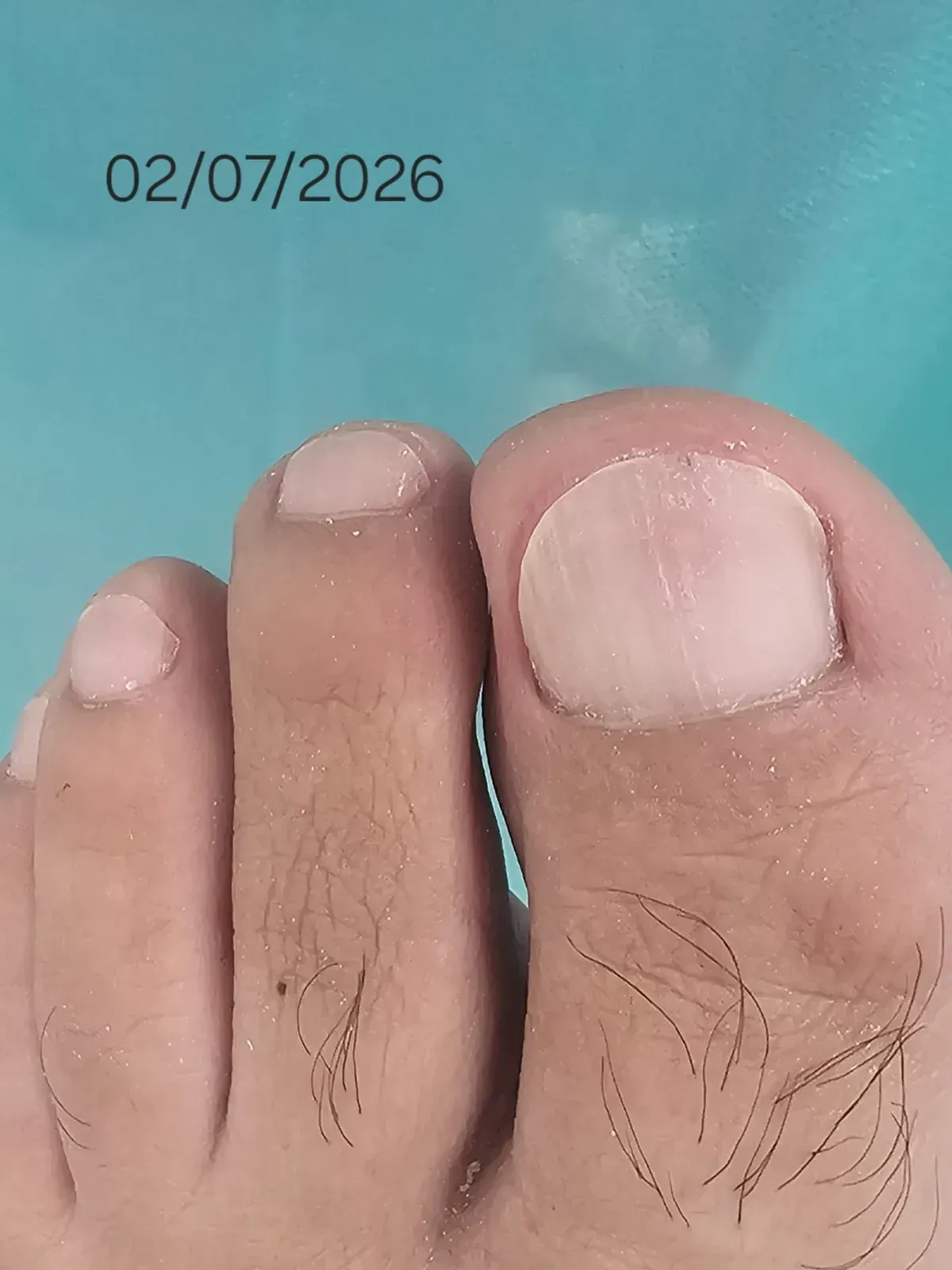 A mesma unha em julho de 2026
