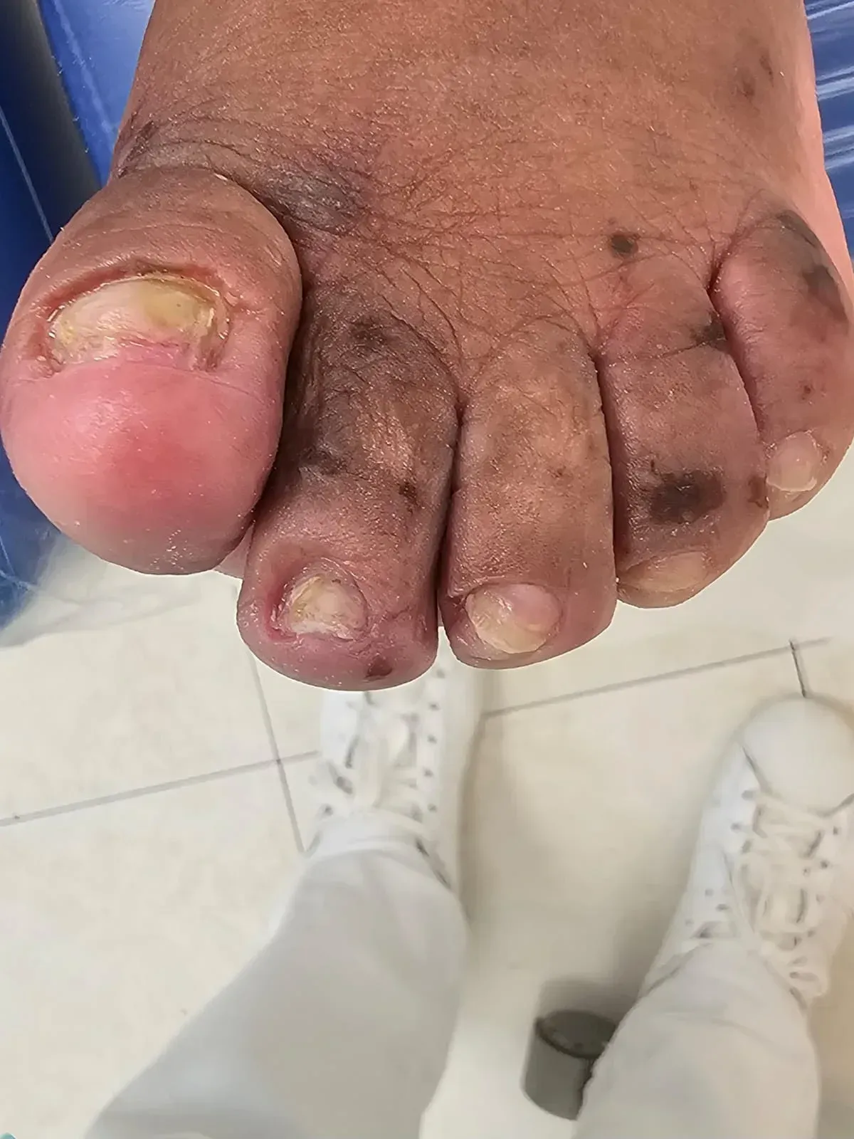 As mesmas unhas depois do desbaste e corte técnico
